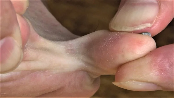 【足のにおい】足裏筋肉モッコリ-9