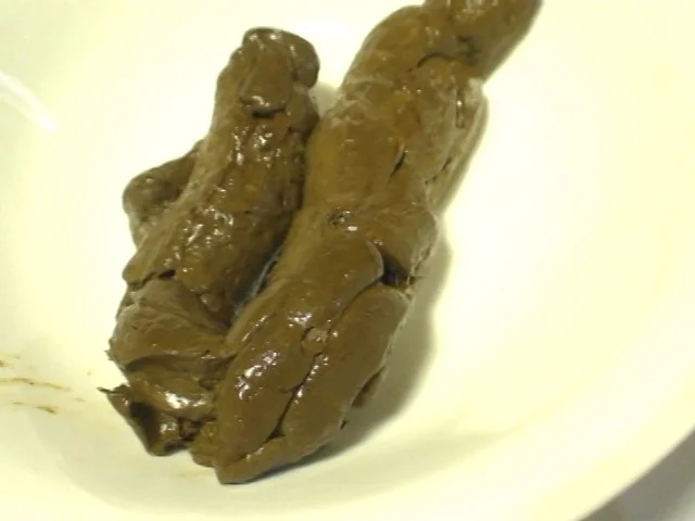 糞一週間-2