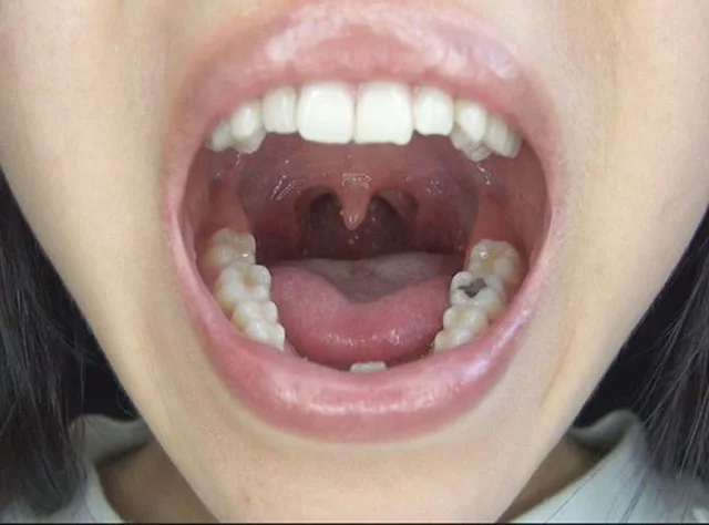 100人のおくち 第9集-11