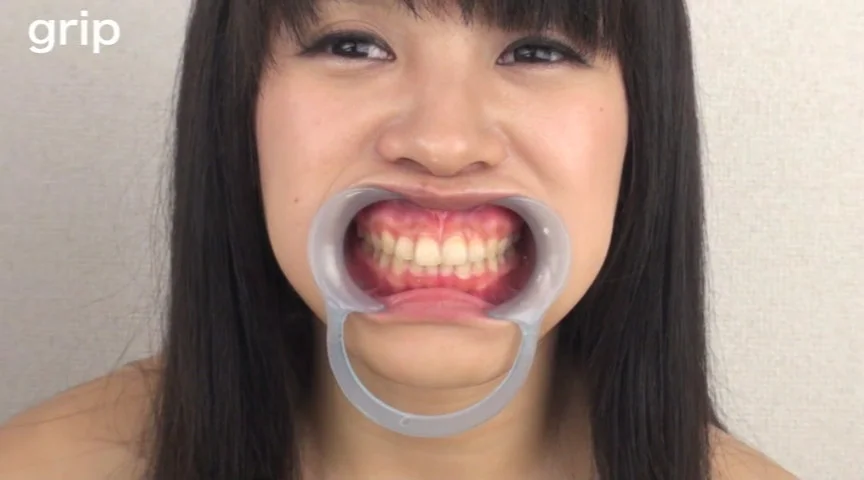 口腔粘膜剥き出し絶頂！！開口狂器 倉科もえ-1