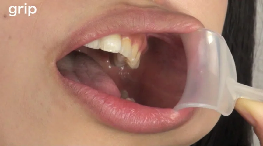 口腔粘膜剥き出し絶頂！！開口狂器 倉科もえ-3