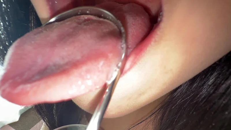 【個人撮影】桃瀬まゆの舌ブラシで「汚舌苔」採取-11