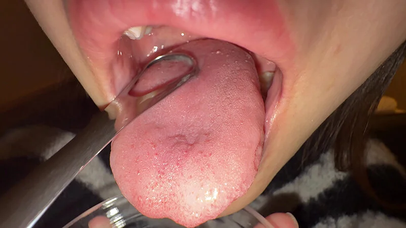 【個人撮影】さくまつなの舌ブラシで「汚舌苔」採取-11