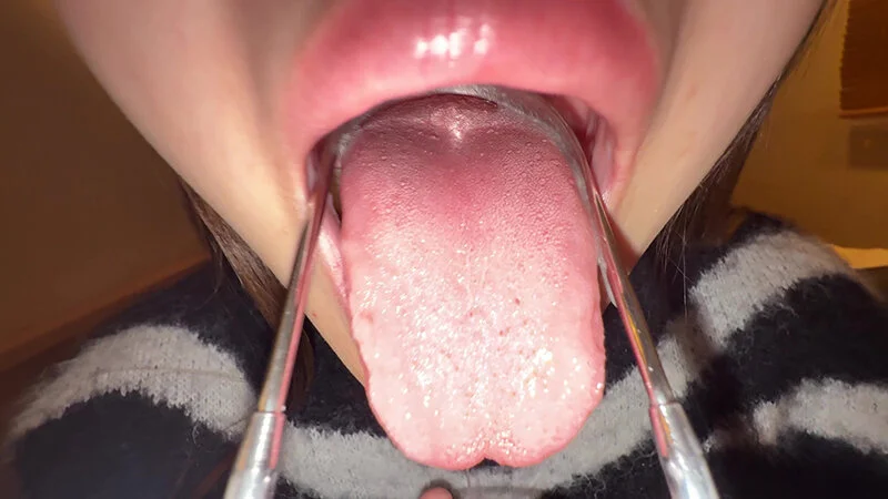 【個人撮影】さくまつなの舌ブラシで「汚舌苔」採取-17